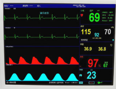 Nerve stimulation for chronic pain